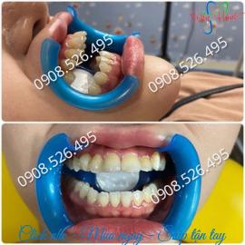Banh môi xanh nhựa dẻo có gương
